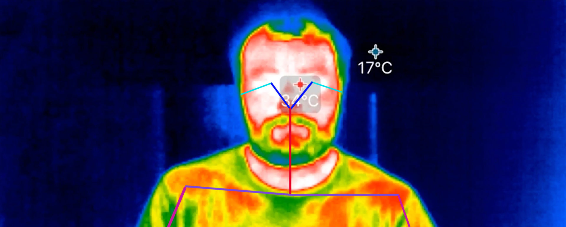 Why This Expert Doesn't Think Crowd Temp Screening is a Joke Synapse